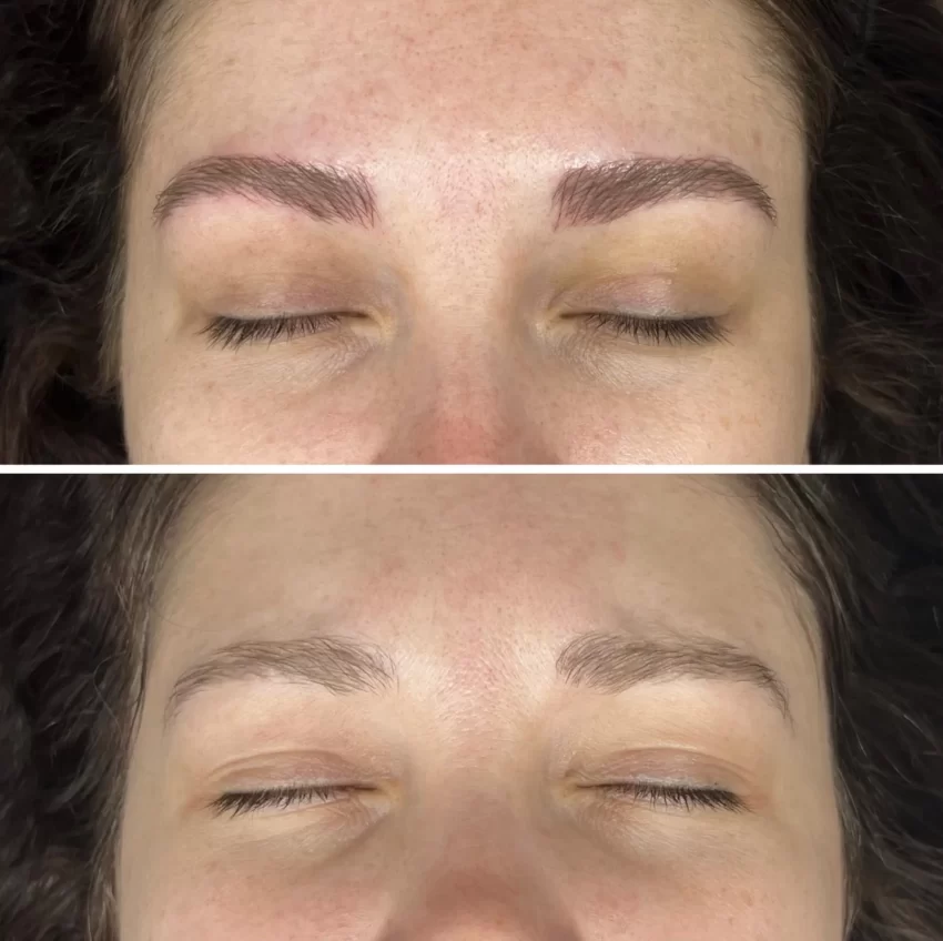 Cosmetic Tatooing