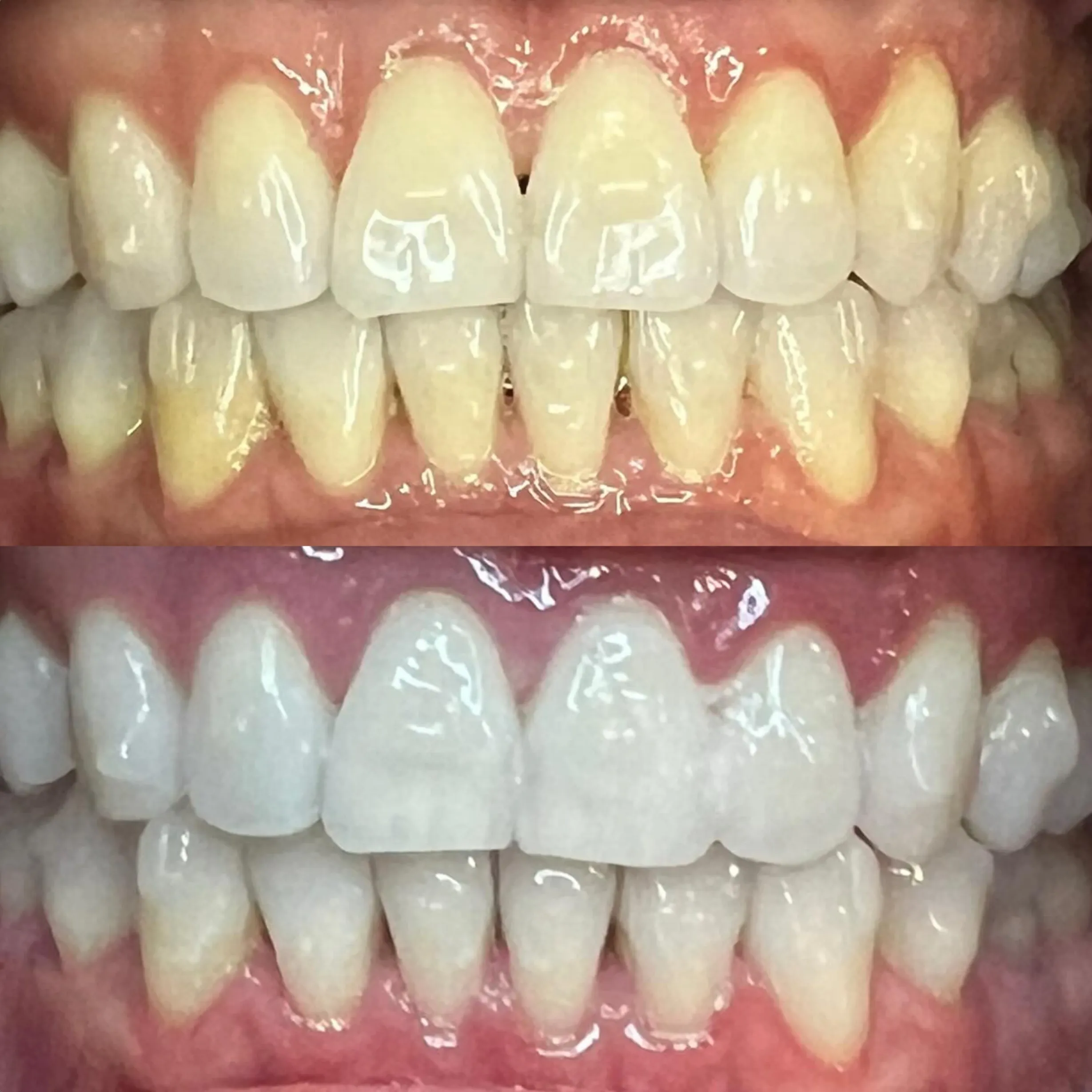 flexible teeth whitening certification