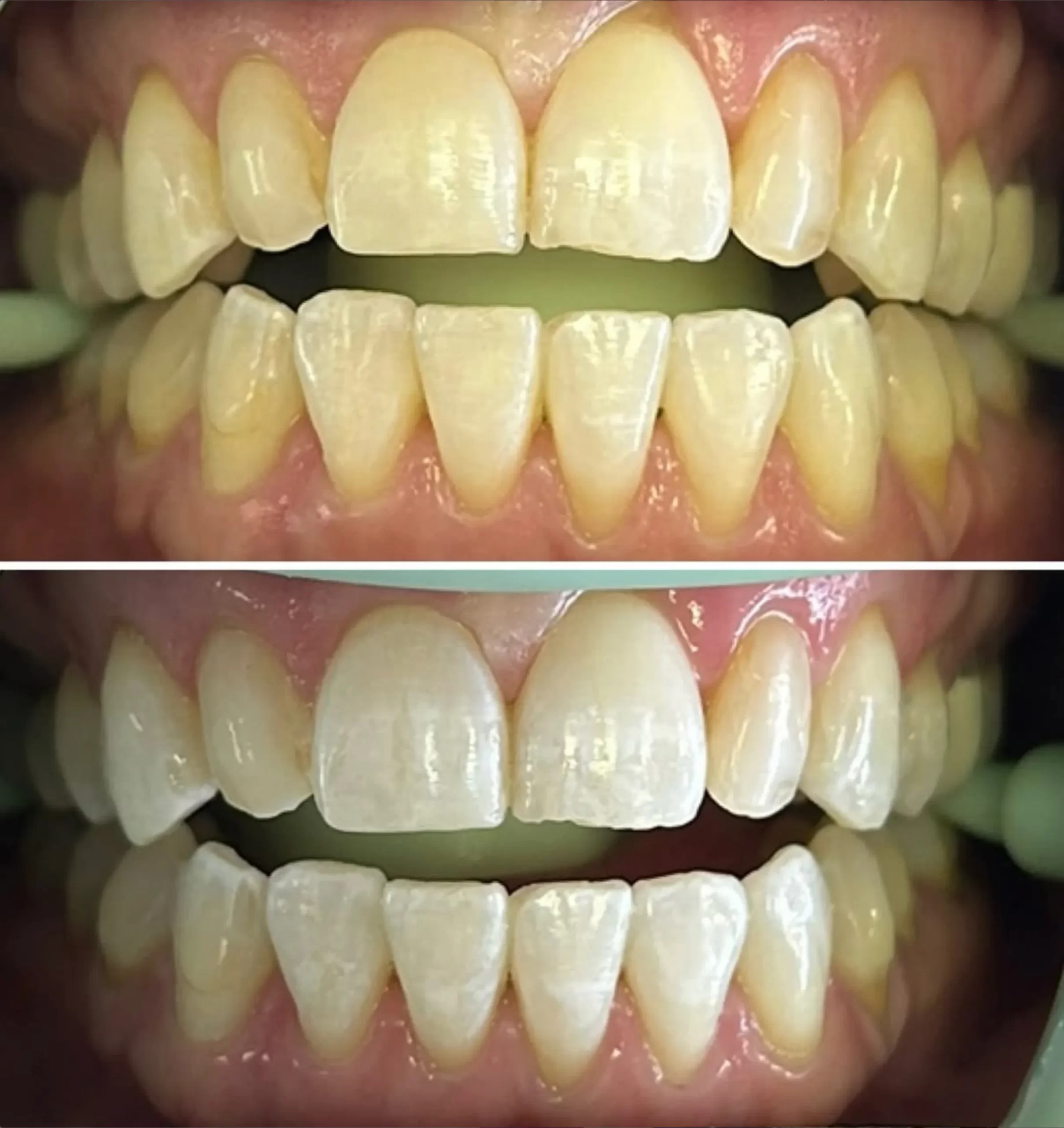 part-time cosmetic whitening training