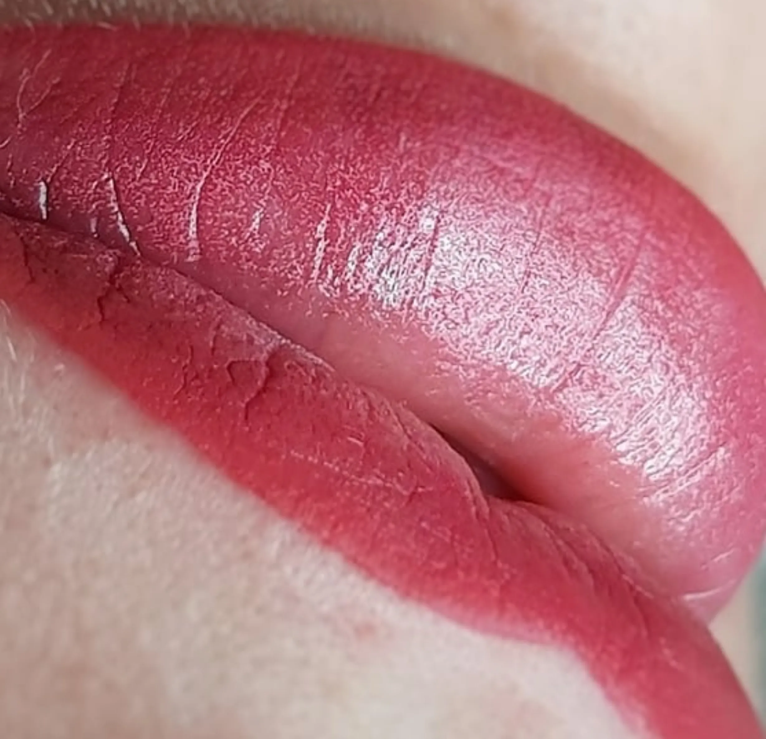 lip tattoo cold sore prevention