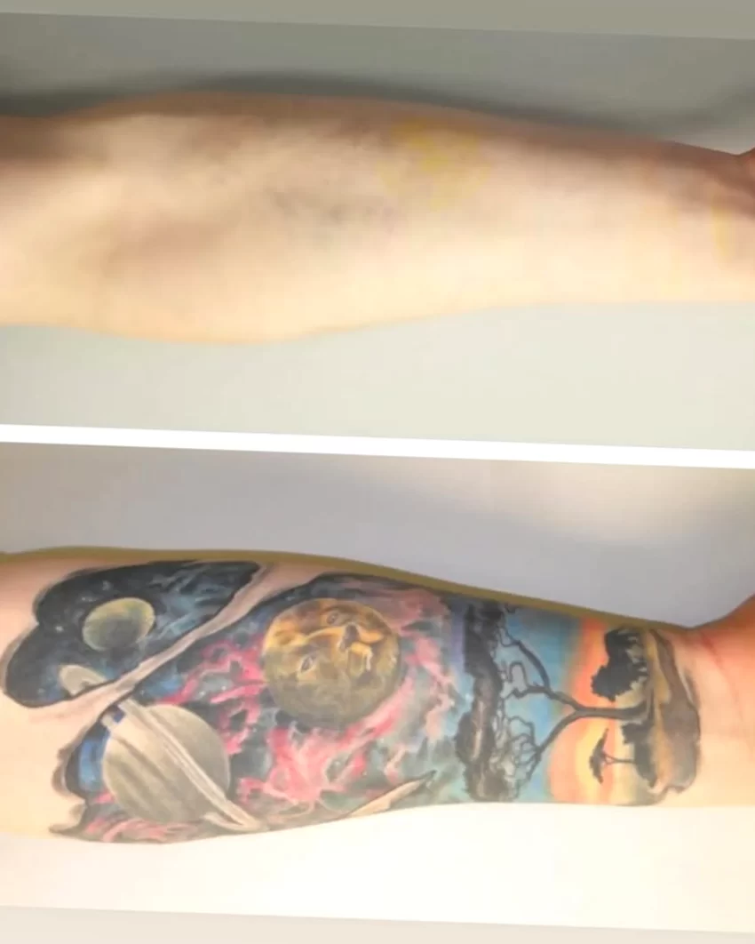 uncertified tattoo removal courses