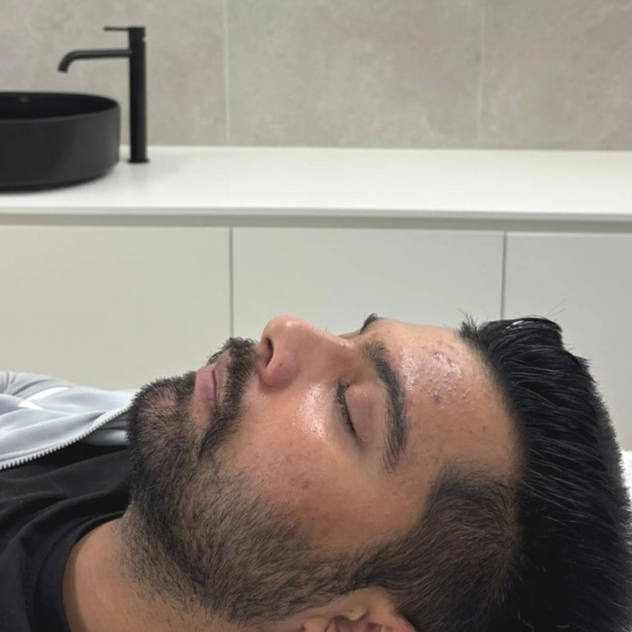 bearded man applying skincare cream