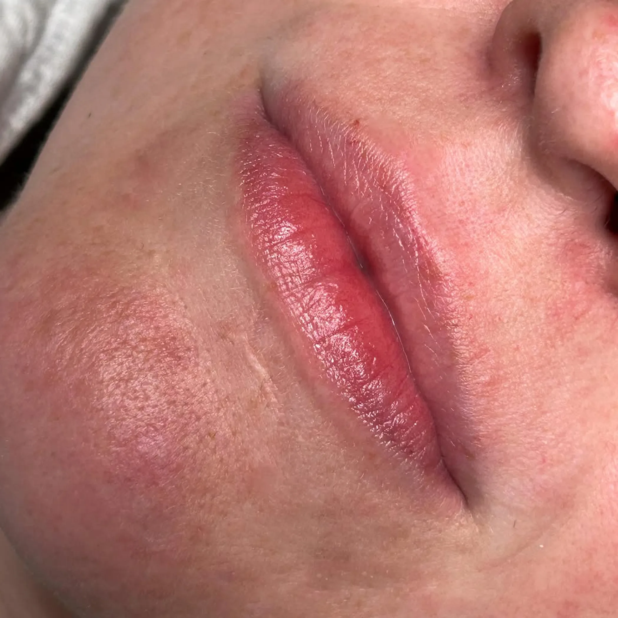 cosmetic lip tattoo results
