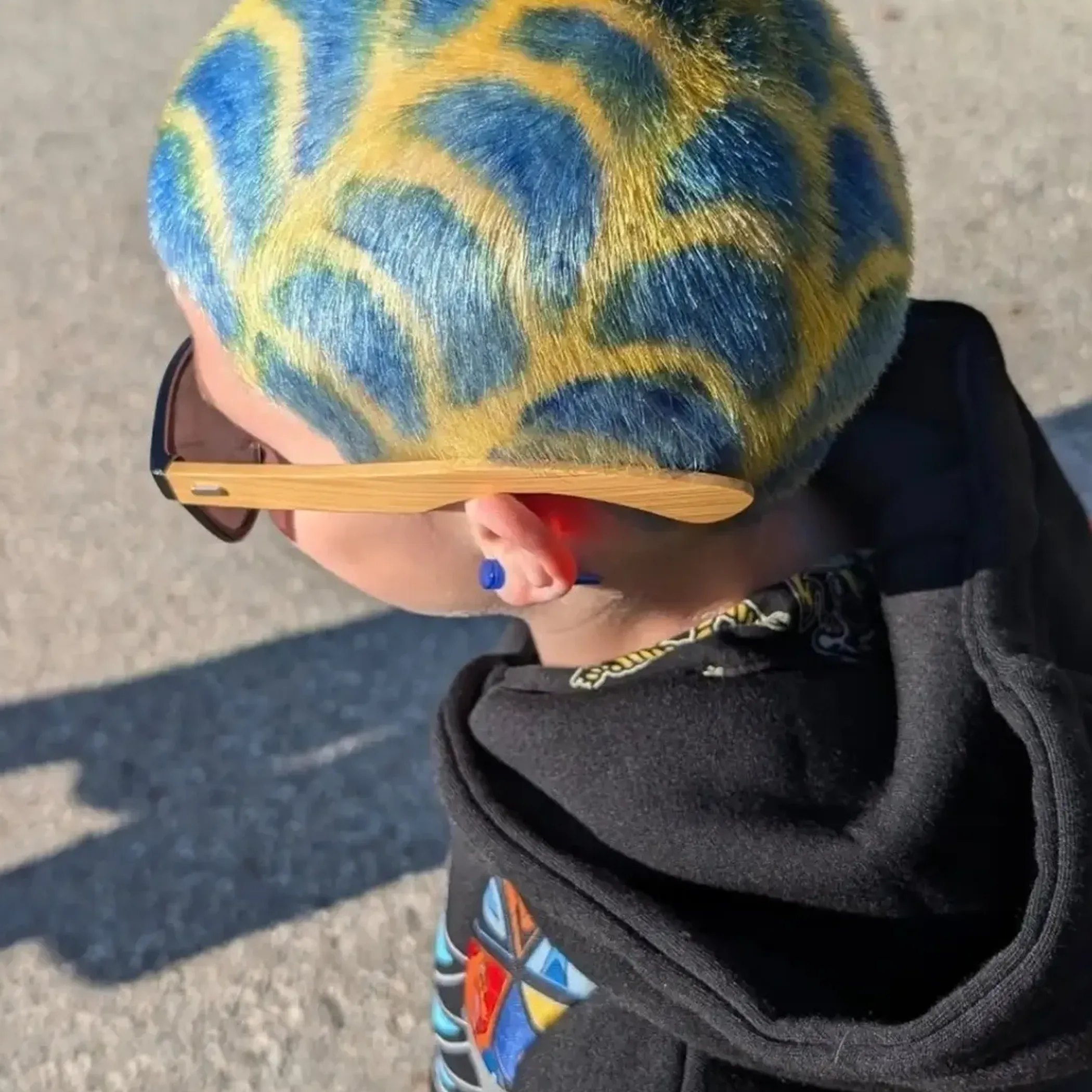 scalp micropigmentation hair tattoo